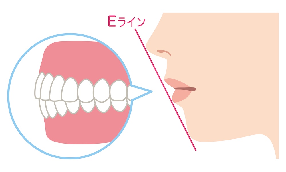 ①前歯の見え方・Eラインとのバランス