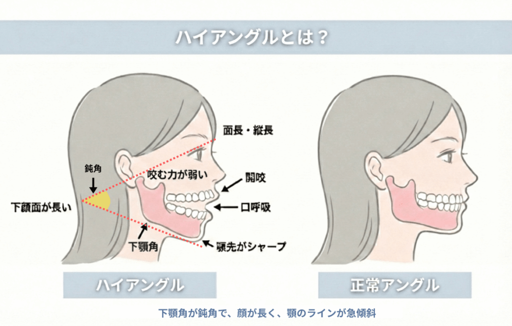 ハイアングルとは