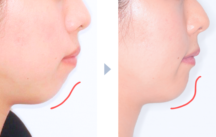 治療前後の比較