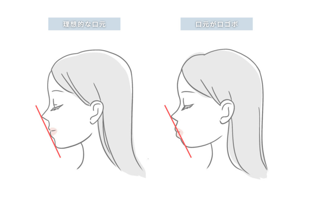 Eラインの説明イラスト