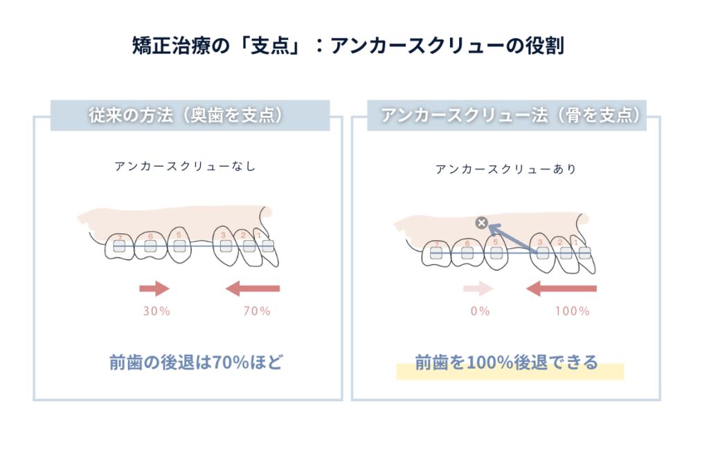 矯正アンカースクリューの役割