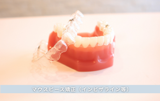 マウスピース矯正（インビザライン等）