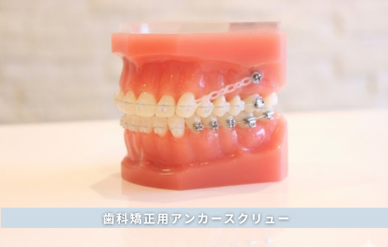 歯科矯正用アンカースクリュー