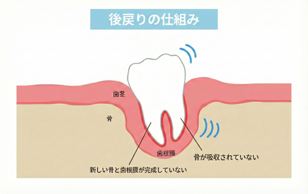後戻りの仕組み