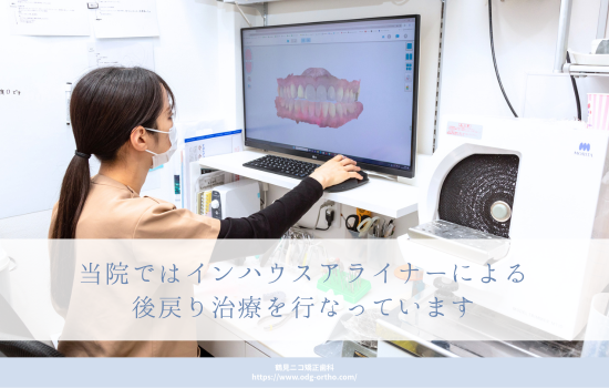 当院ではインハウスアライナーによる後戻り治療を行なっています
