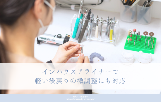 インハウスアライナーで軽い後戻りの微調整にも対応