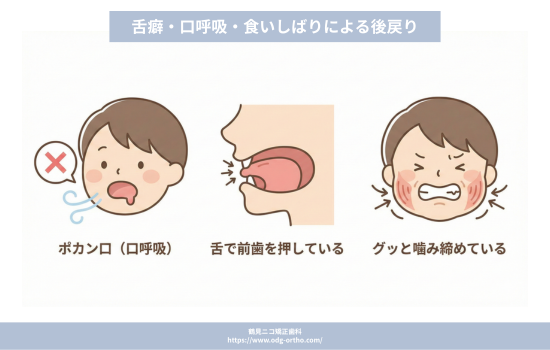 舌癖・口呼吸・食いしばりによる後戻り