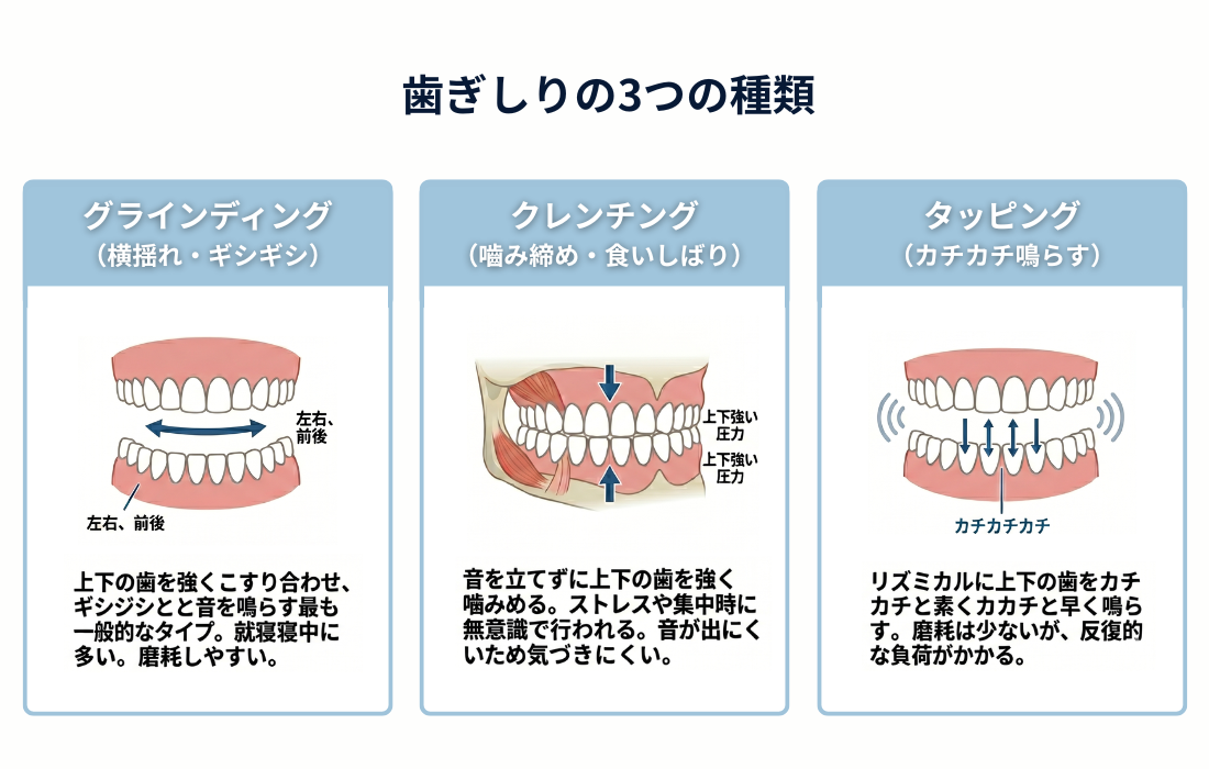 歯ぎしりの3つの種類
