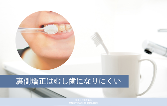 裏側矯正はむし歯になりにくい