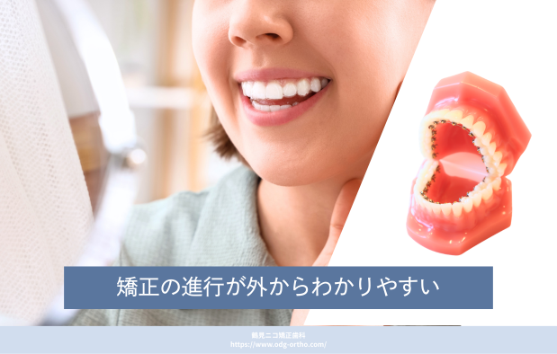 矯正の進行が外からわかりやすい