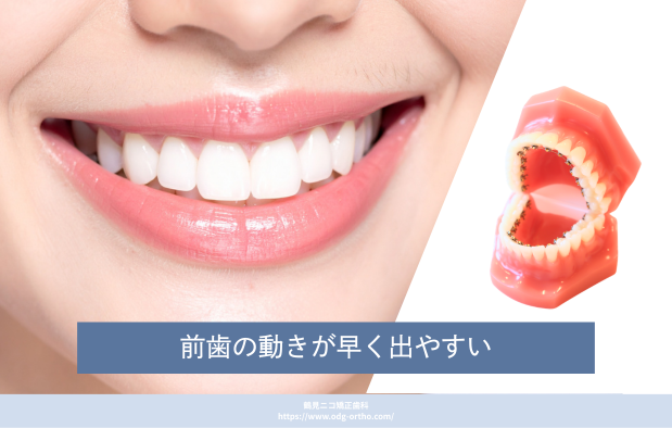 前歯の動きが早く出やすい