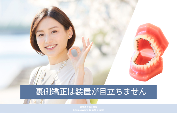 裏側矯正は装置が目立ちません