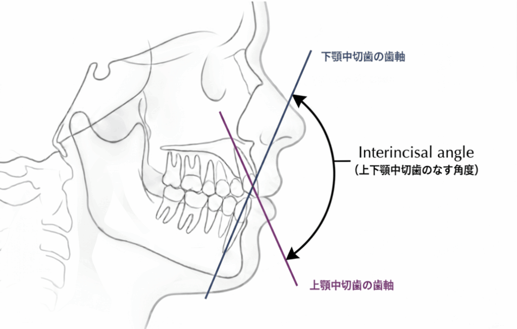 Interincisal angle