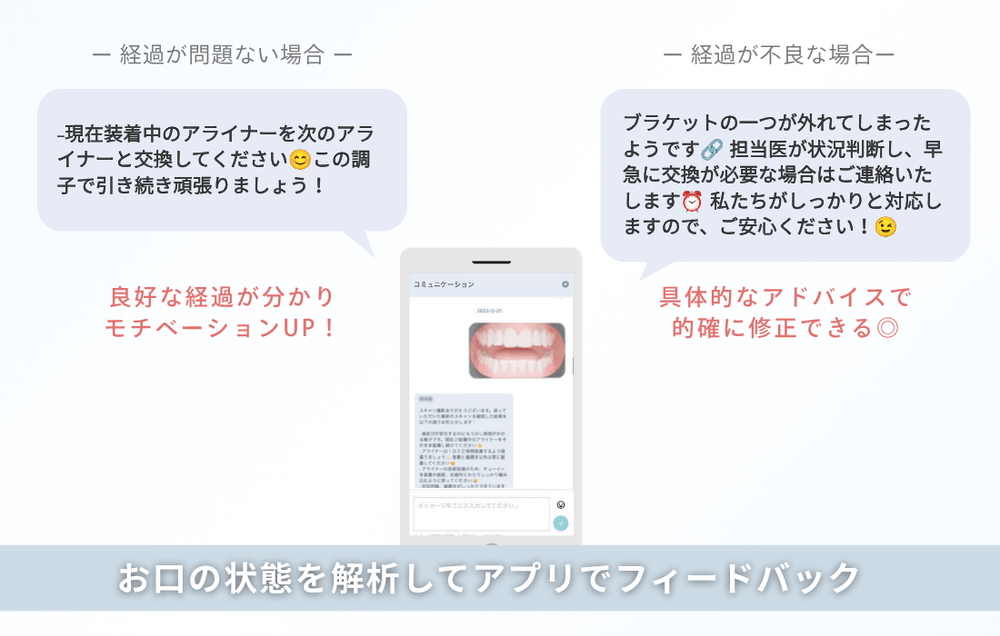 お口の状態を解析してアプリでフィードバック
