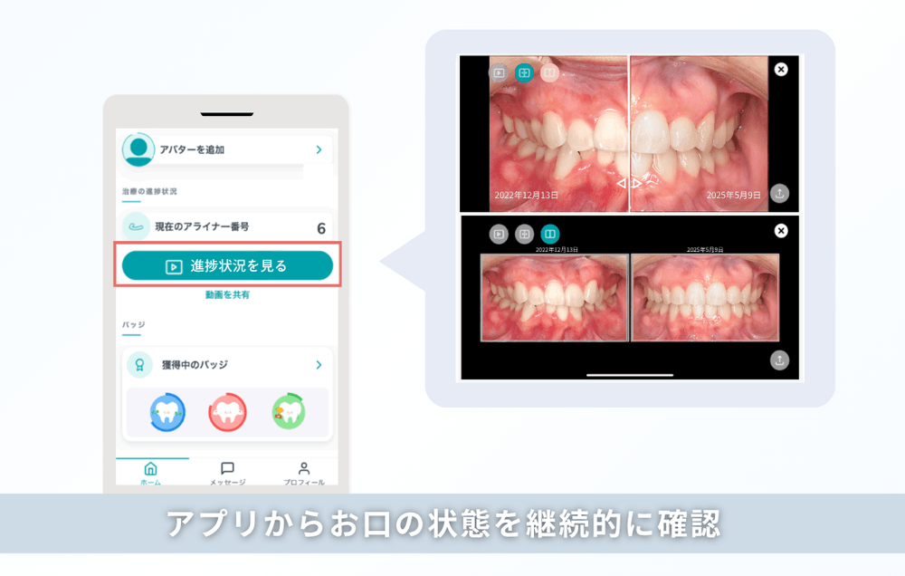 アプリからお口の状態を継続的に確認