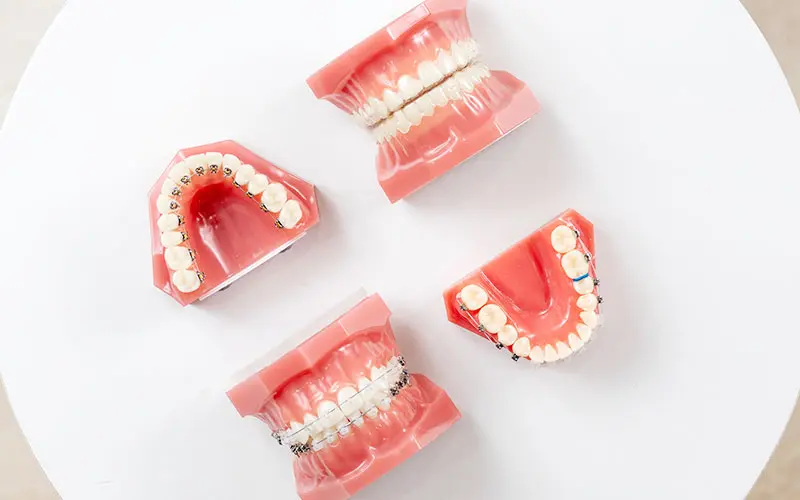 様々な矯正装置