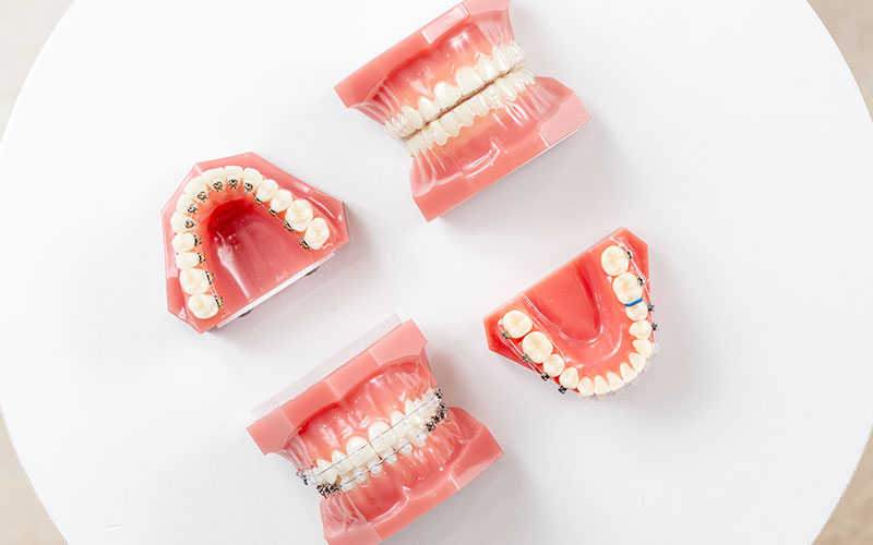 様々な矯正装置