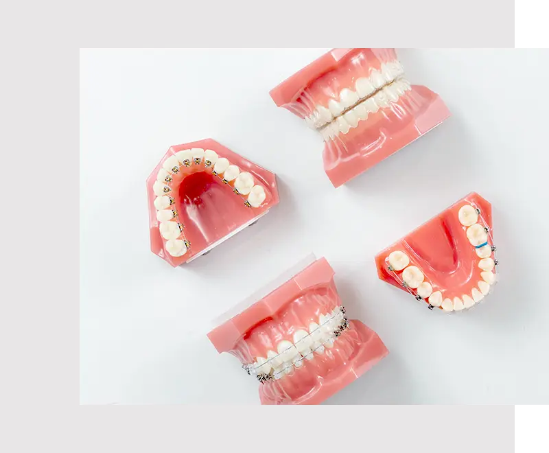 様々な矯正方法を網羅