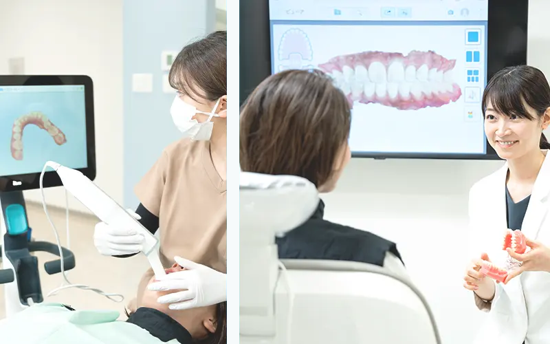 アウトカムシミュレーション