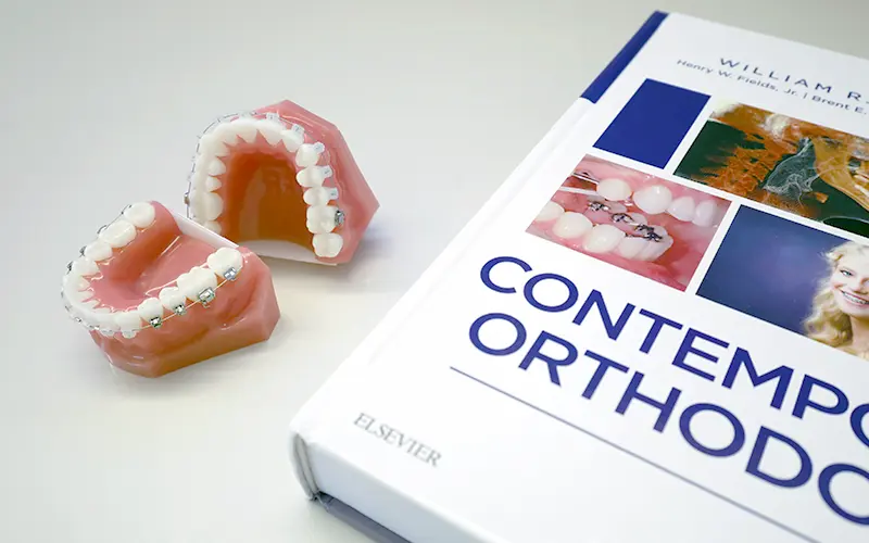 審美ブラケット・ワイヤー