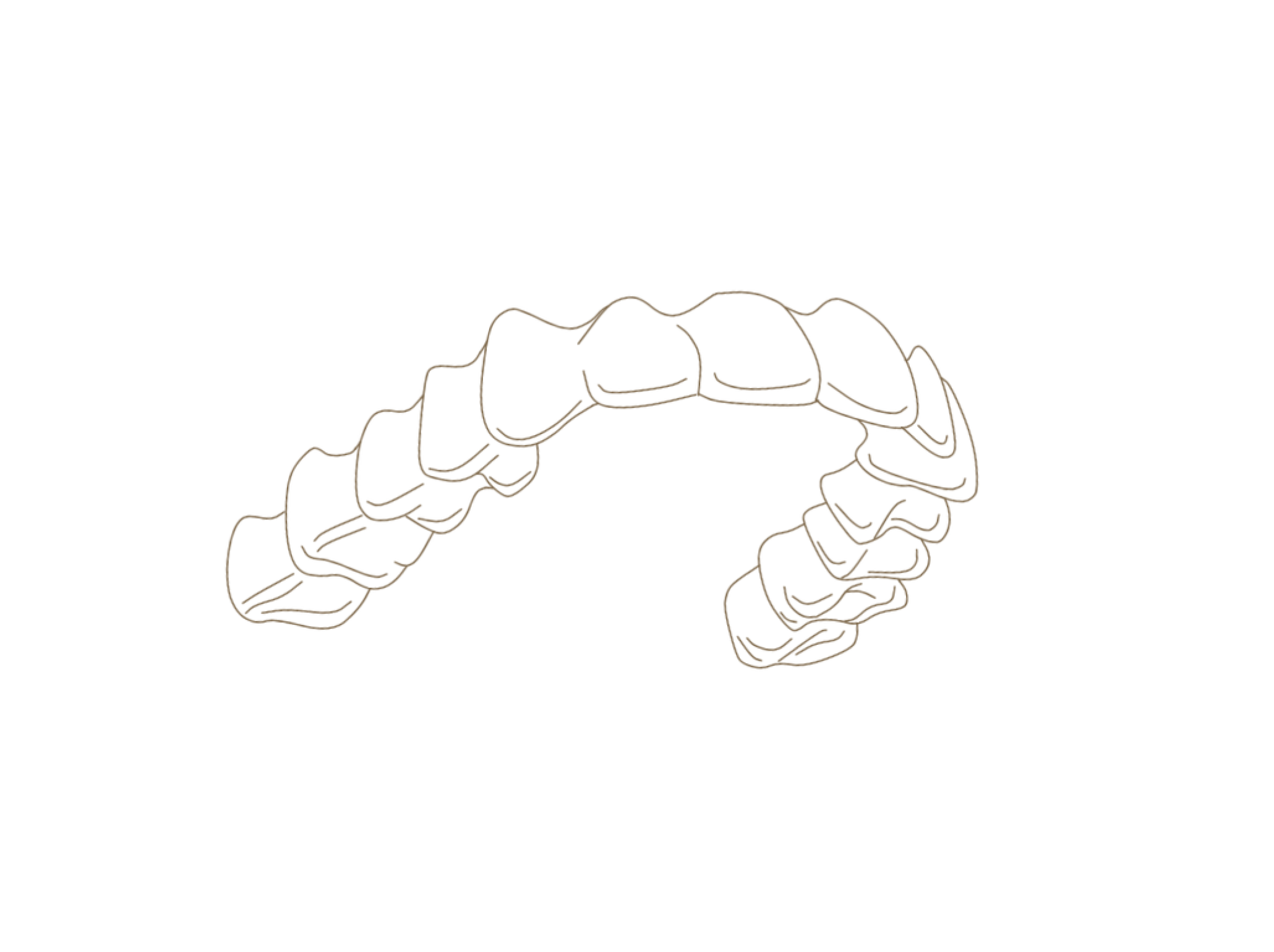 マウスピース型矯正