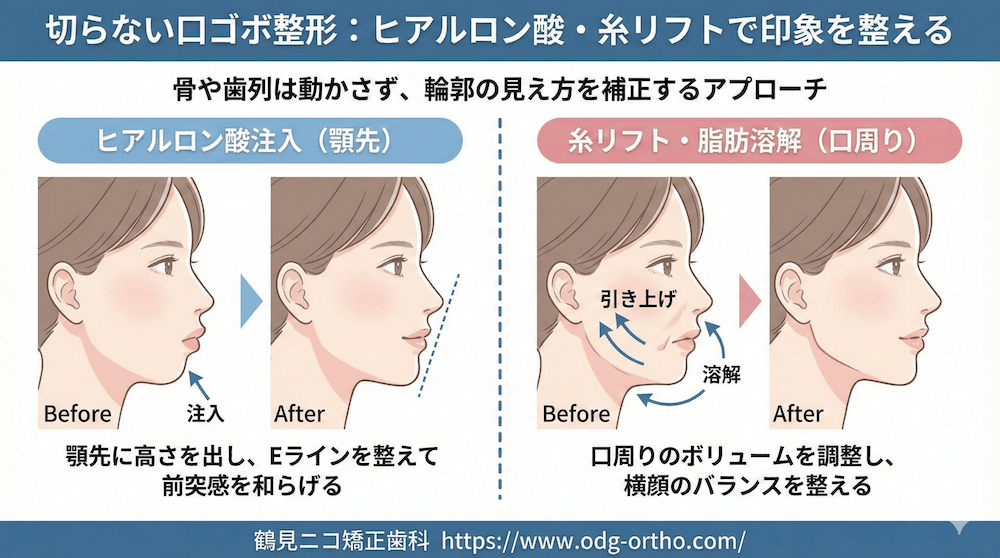 大阪市鶴見区で歯並び治療（歯列矯正）なら鶴見ニコ矯正歯科｜矯正専門