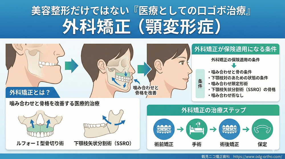 美容整形だけではない「医療としての口ゴボ治療」外科矯正（顎変形症）